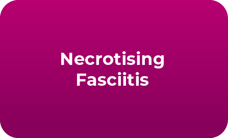 Necrotising Fasciitis