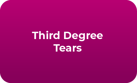 Third Degree Tears